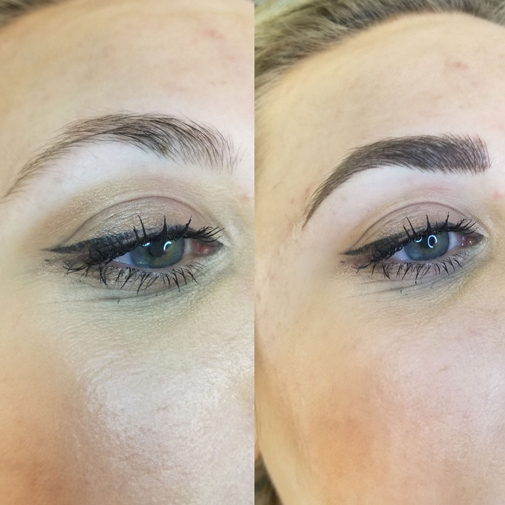 Eyebrow Microblading Before and After